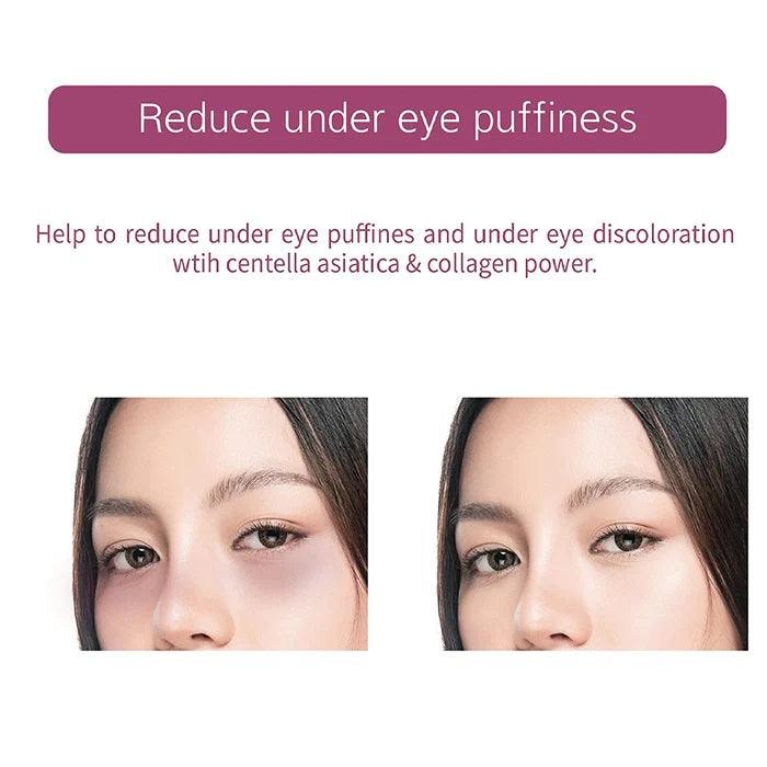 Veraclara Powerful Collagen Eye Patches - 5 Pairs -Veraclara- DynaMart